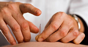 Acupuncture needle insertion Picture